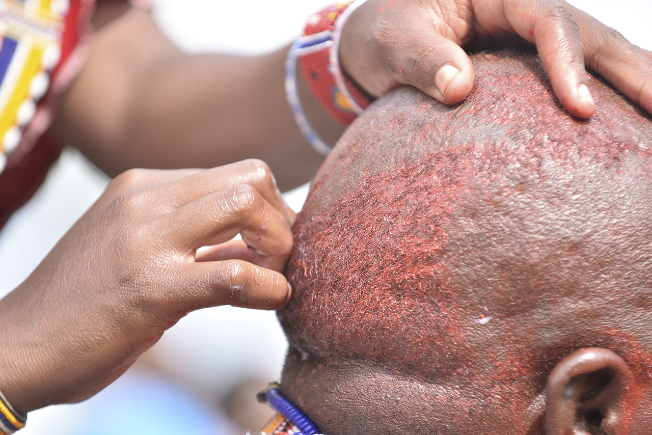 A Cancer patient shaving head.