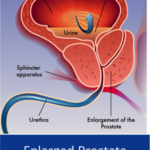 What is the relationship between ejaculation and prostate cancer?